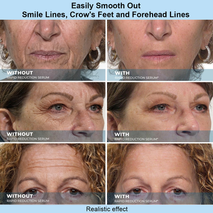 Leanviy™ Instant Face Temporary Tightener – Instant visible results in 30 seconds