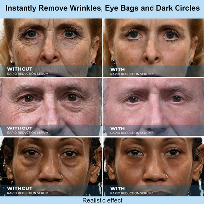 Leanviy™ Instant Face Temporary Tightener – Instant visible results in 30 seconds
