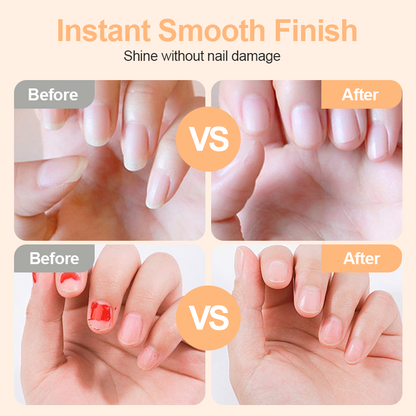 ✂️LIMITED-TIME DEAL ! 💅2-in-1 Smart Electric Nail Clipper & Polisher🌟
